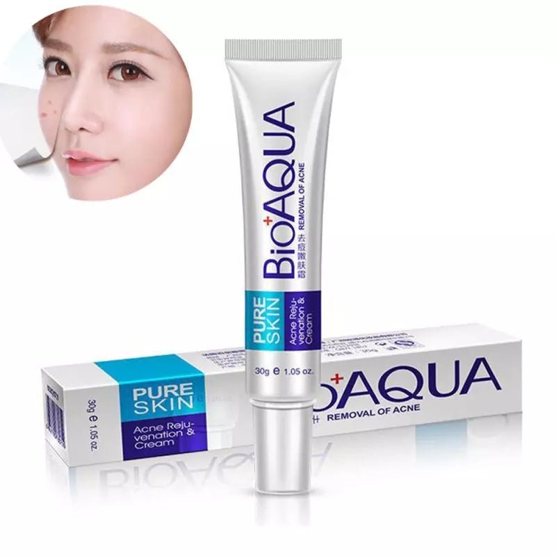 Bioaqua 30g Acne Treatment Blackhead Removal Cream - Neozen Store